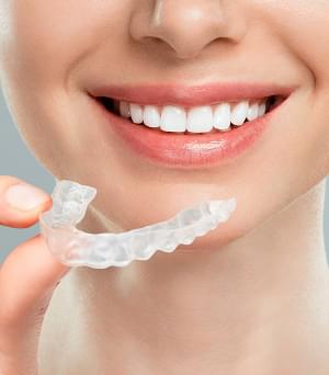 マウスピース矯正