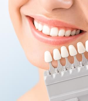 ホワイトニング